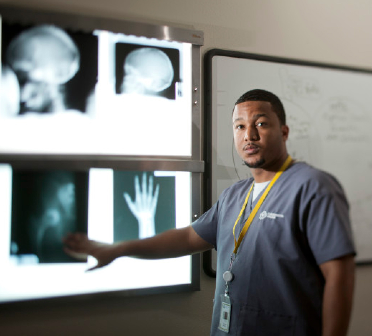 Carrington College Medical Radiography student pointing to x-ray scans