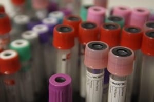 A blood test may help predict Alzheimer's disease.